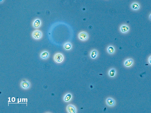 Chlorella vulgaris mit eingelagerten Speicherlipiden.