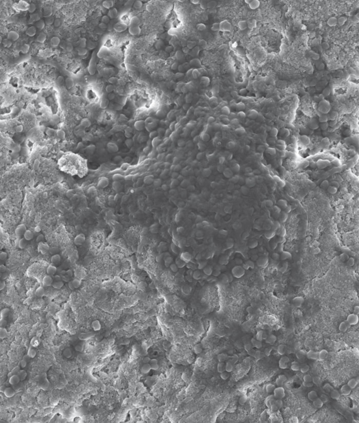 Rasterelektronenmikroskopische Aufnahme eines Biofilms der Spezies S. aureus auf der Oberfläche von CaP-Apatit des CIRIMAT-Instituts ohne antimikrobielle Ausrüstung.