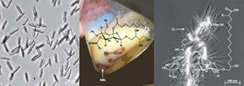 Zellen des Brandpilzes Ustilago maydis und hergestelltes Biotensid Zellen des Brandpilzes Ustilago maydis.