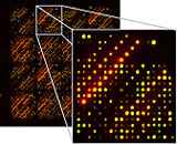 Ausschnitt aus dem DNA-Chip zur therapiebegleitenden Diagnose von Brustkrebs.