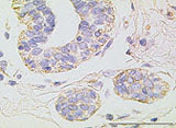 Immunohistochemische Untersuchung von TßRII in Brustgewebe: gesundes Gewebe.