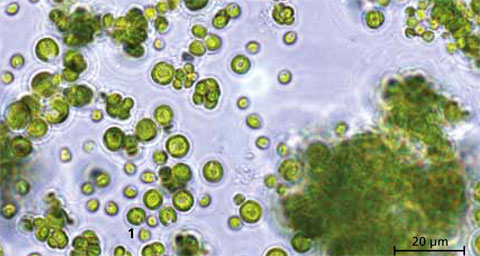 Mikroalge Chlorella vulgaris, 1000fache Vergrößerung.