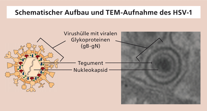 Schematischer Aufbau und TEM-Aufnahme des HSV-1.