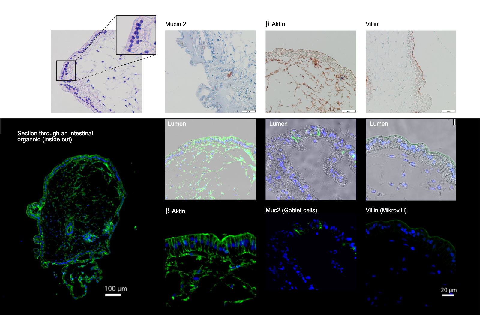 Gewebeaufbau und Proteinmarker Intestinaler Organoide entsprechen exakt dem Expressionsmuster des humanen In-vivo Dünndarms (Immunhistochemische Färbungen von Gewebedünnschnitten auf die darmspezifische Expressionsmarker -Aktin, Mucin 2 und Mikrovillin).