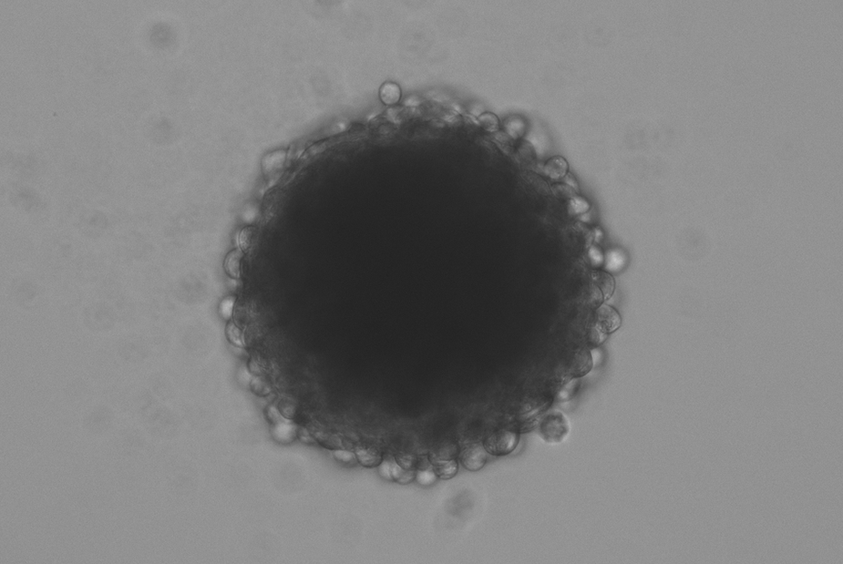 Fibroblasten-Sphäroid
