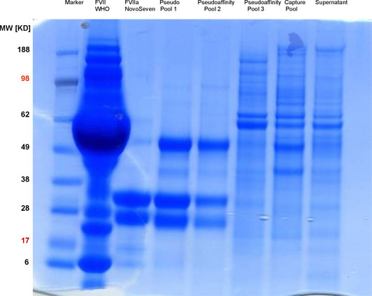 SDS-Gelelektrophorese der Referenzsubstanzen und der Reinigungsstufen von Faktor VII.