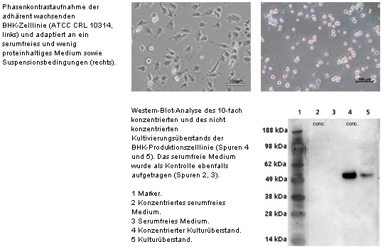 Phasenkontrastaufnahme der adhärent wachsenden BHK-Zelllinie (ATCC CRL 10314, links) und adaptiert an ein serumfreies und wenig proteinhaltiges Medium sowie Suspensionsbedingungen (rechts)