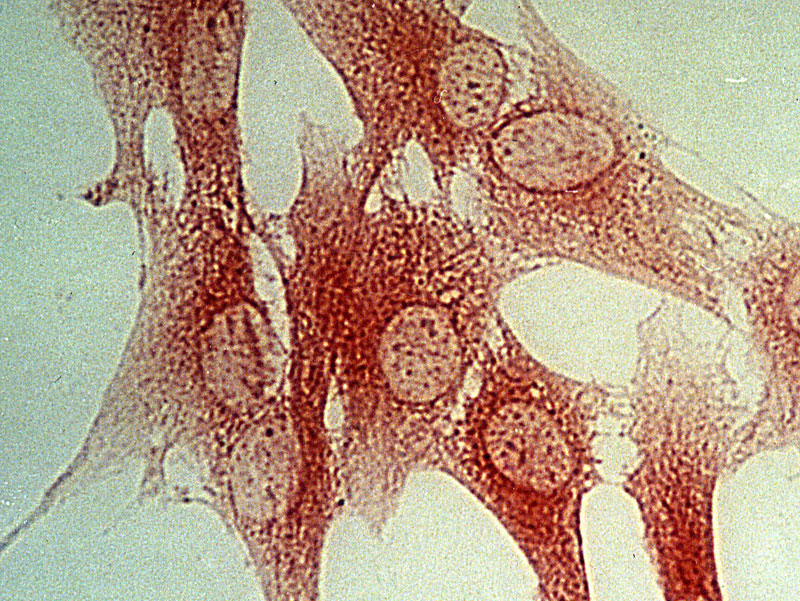 Sromazellen Stromazellen