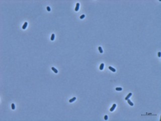 Lichtmikroskopische Aufnahme von Zellen des gram-negativen Bakteriums Methylorubrum extorquens AM1. 