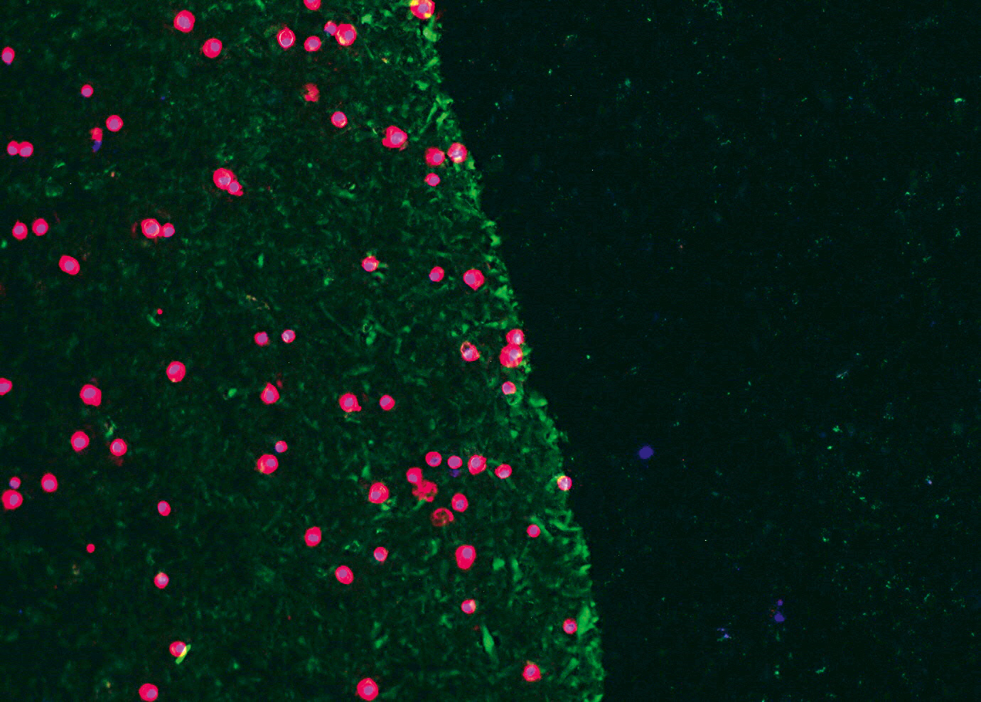 Mesenchymale Stammzellen (rot) auf Albumin­beschichtung (grünlich fluoreszierend) und unbeschichtetem Ti6Al4V (schwarz) nach einer Minute.
