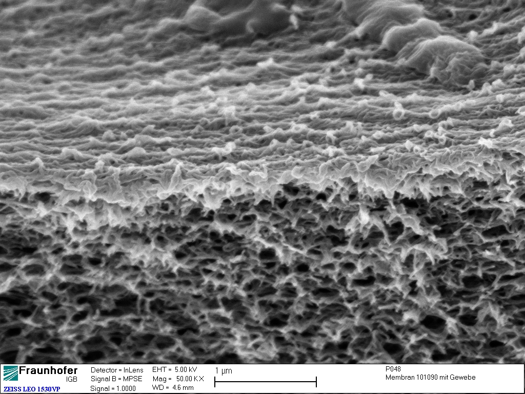 Celluloseacetat-Membran (vergrößerter Ausschnitt der Trennschicht) unter dem Elektronenmikroskop