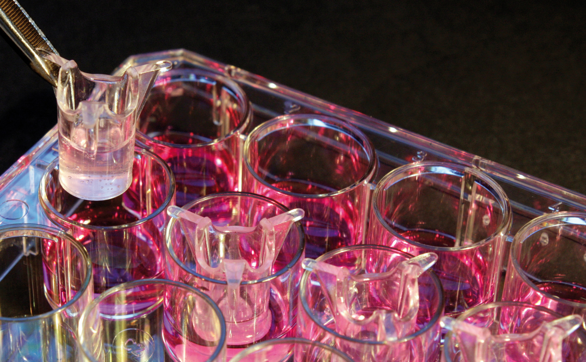 Aufbau eines In-vitro-Infektionsmodells. Aufbau eines In-vitro-Infektionsmodells.