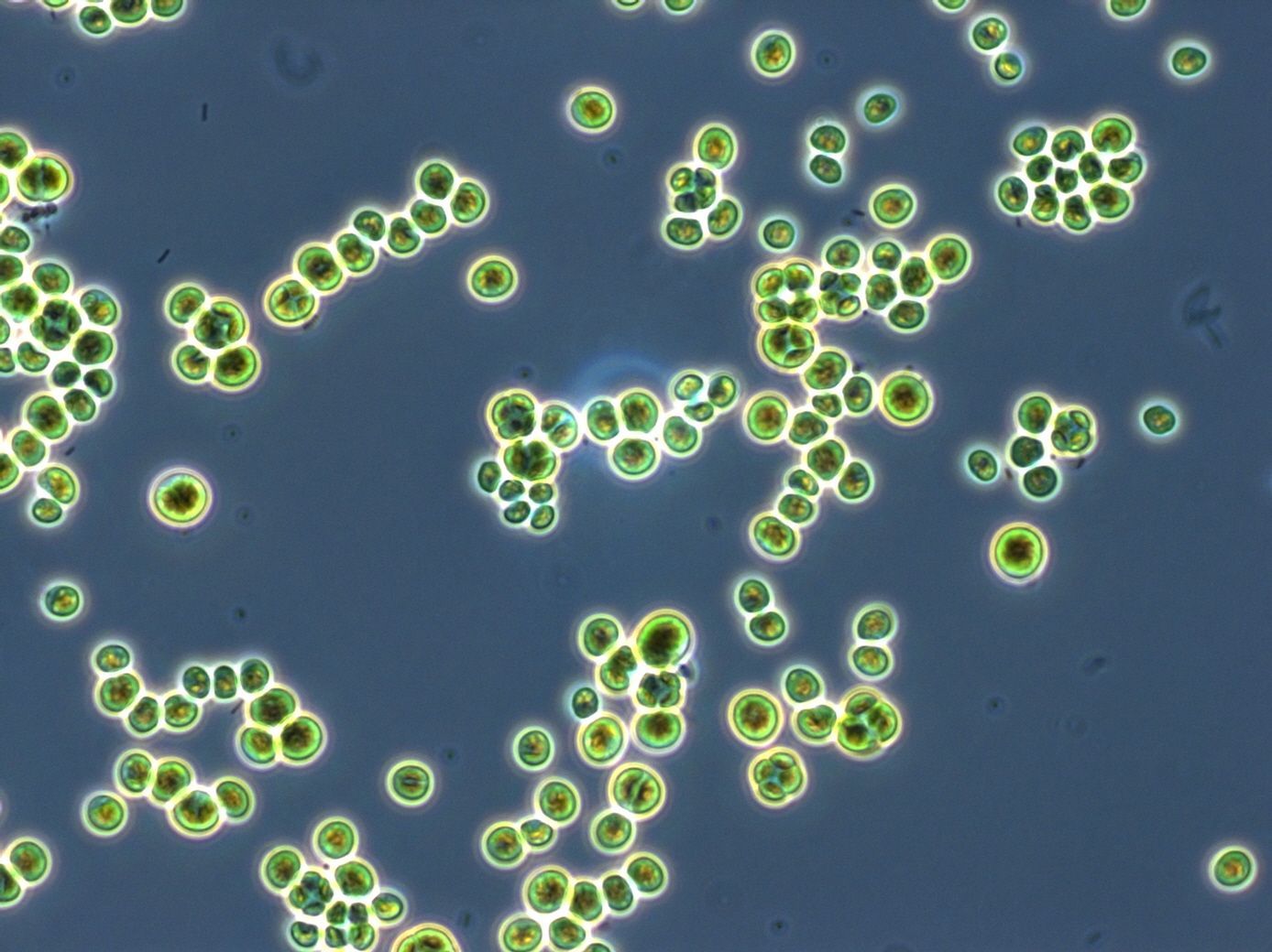 Mikroskopische Aufnahme der Mikroalge Chlorella, 1000-fache Vergrößerung.