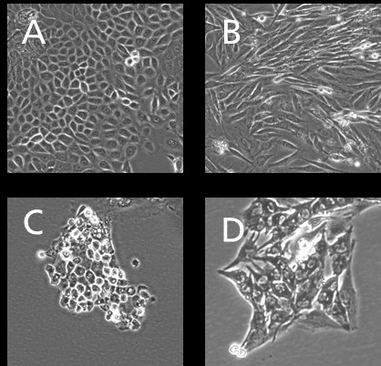 Isolierte, primäre Zellen caniner Haut: A) Keratinozyten; B) Fibroblasten, C) Endothelzellen, D) Melanozyten