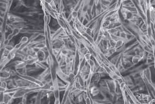 Rasterelektronenmikroskopische Aufnahme eines Biofilms von Candida albicans.
