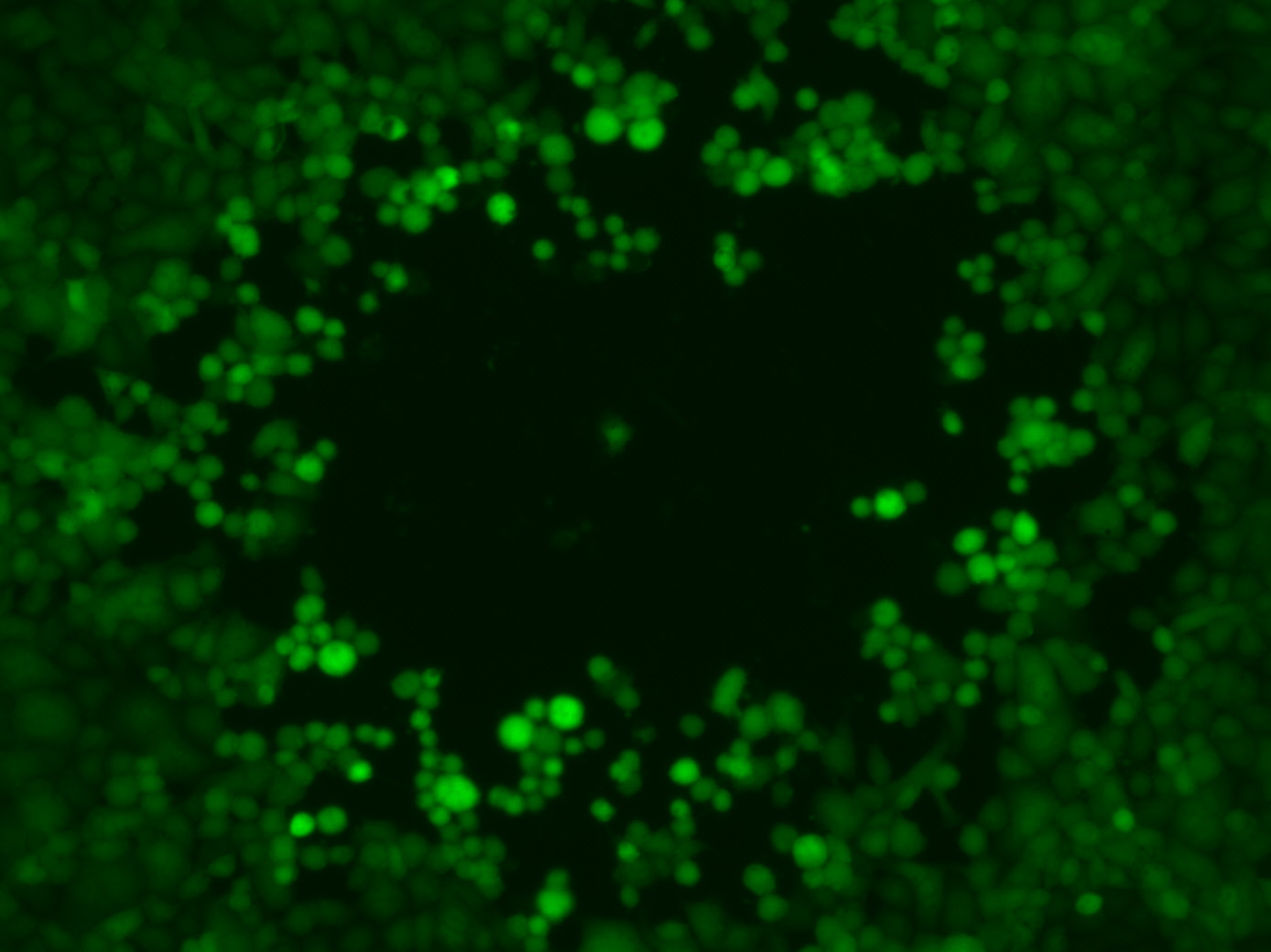 Plaque formation by green fluorescent HSV1 viruses.