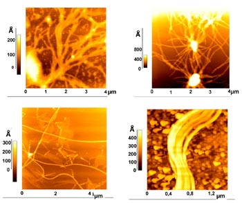 Figure of Alzheimer fibrils.