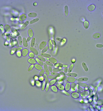 Candida cells and formation of dicarboxylic acid (DCA) from methyl oleate (OME).