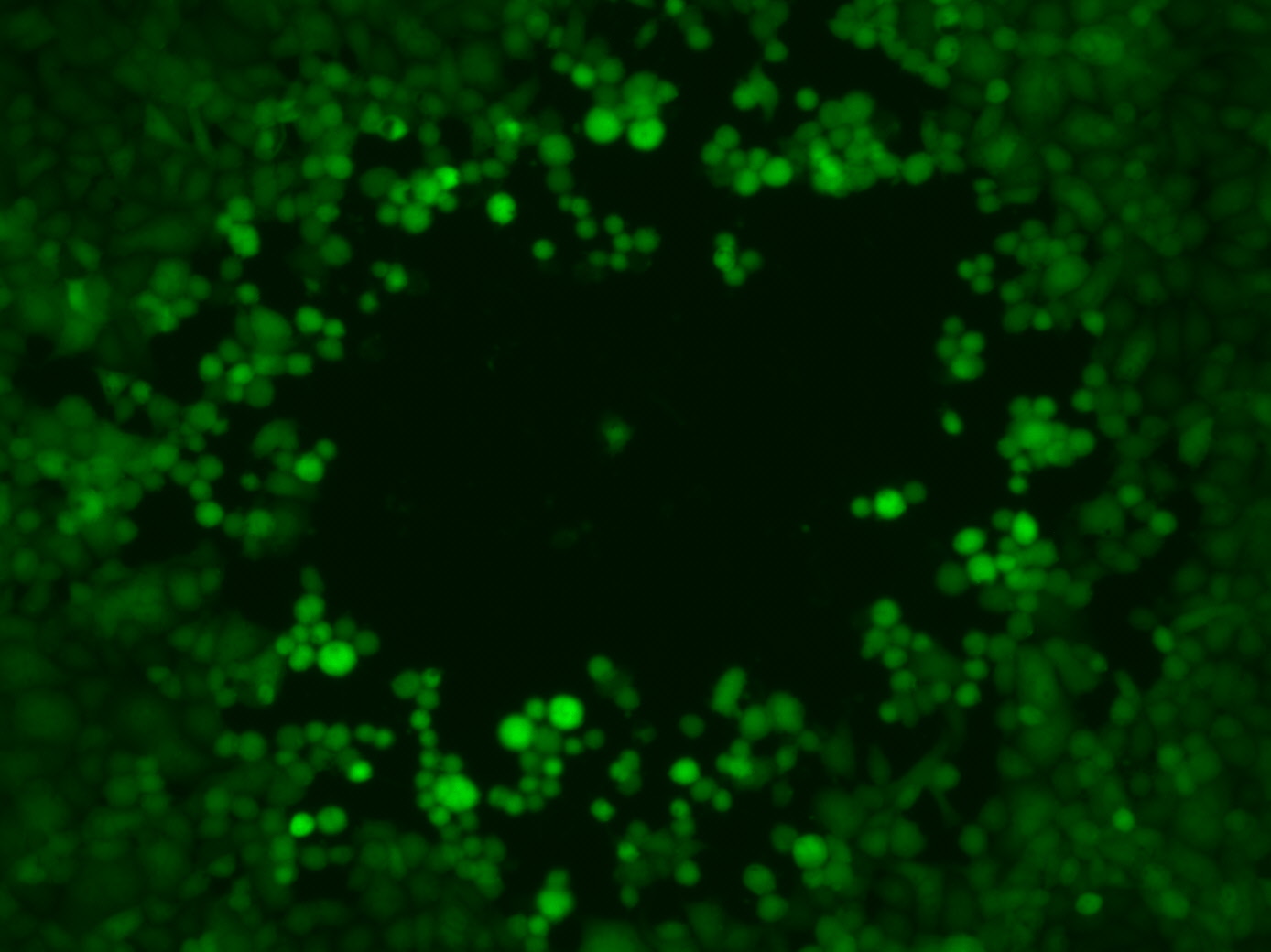 Plaque formation by green fluorescent HSV1 viruses. Plaque formation by green fluorescent HSV1 viruses.