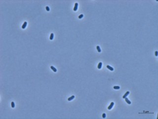Light micrograph of cells of the gram-negative bacte-rium Methylorubrum extor-quens AM1.