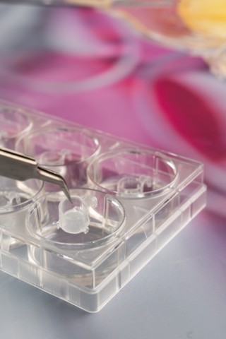 The three-dimensional reporter skin of Fraunhofer IGB is an in-vitro model of human skin, which makes the cellular response to a test substance measurable on the living model using an integrated reporter.