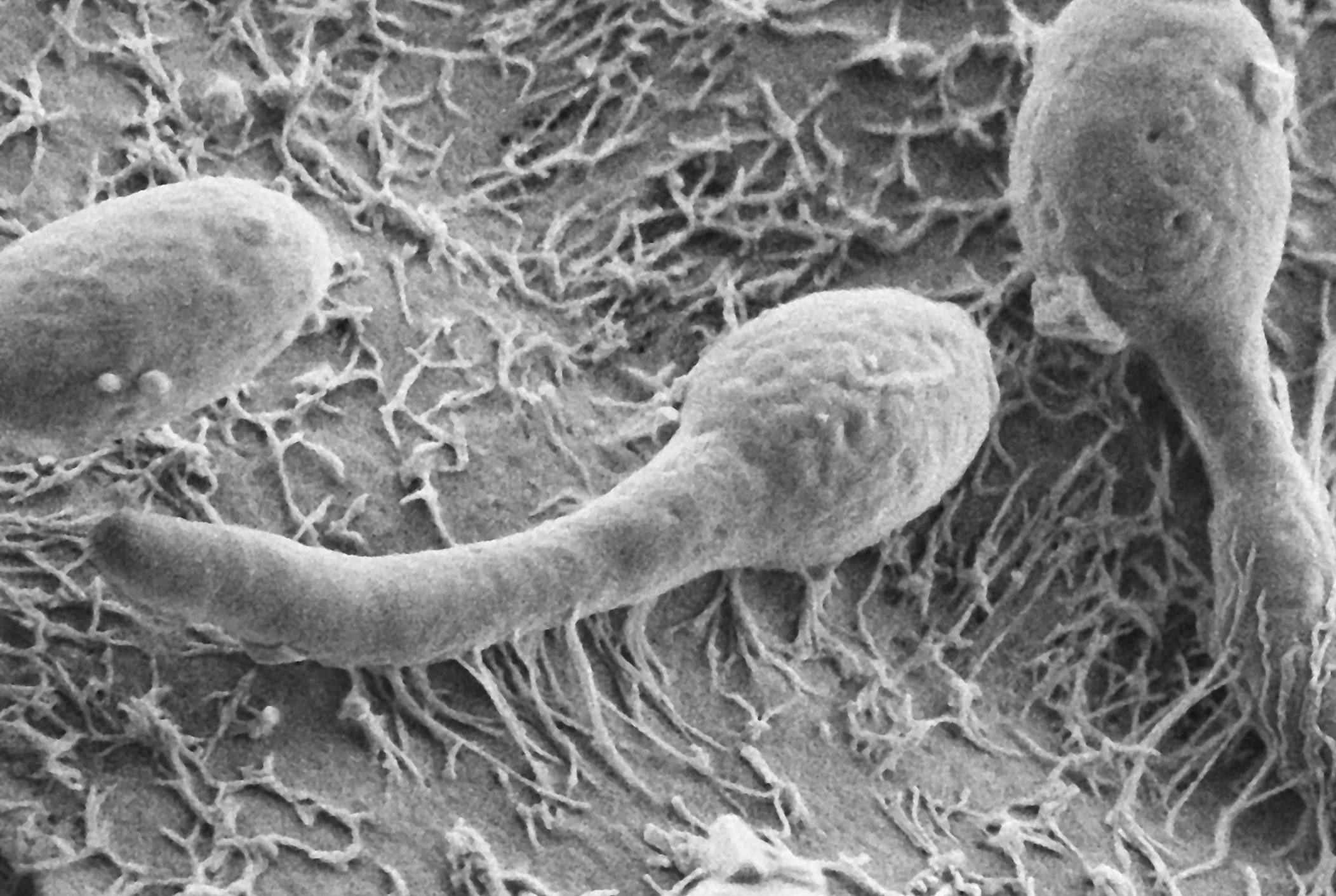 Candida albicans