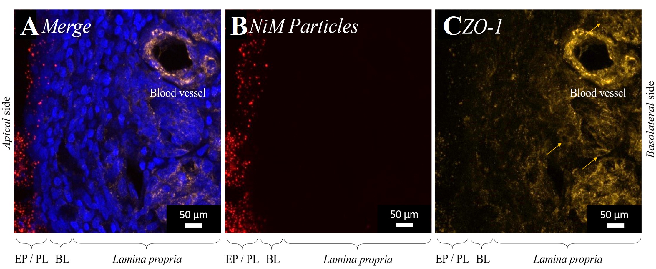 The application of chitosan particles (NiM) causes an opening of the tight junctions in the olfactory mucosa and enables a paracellular transport.