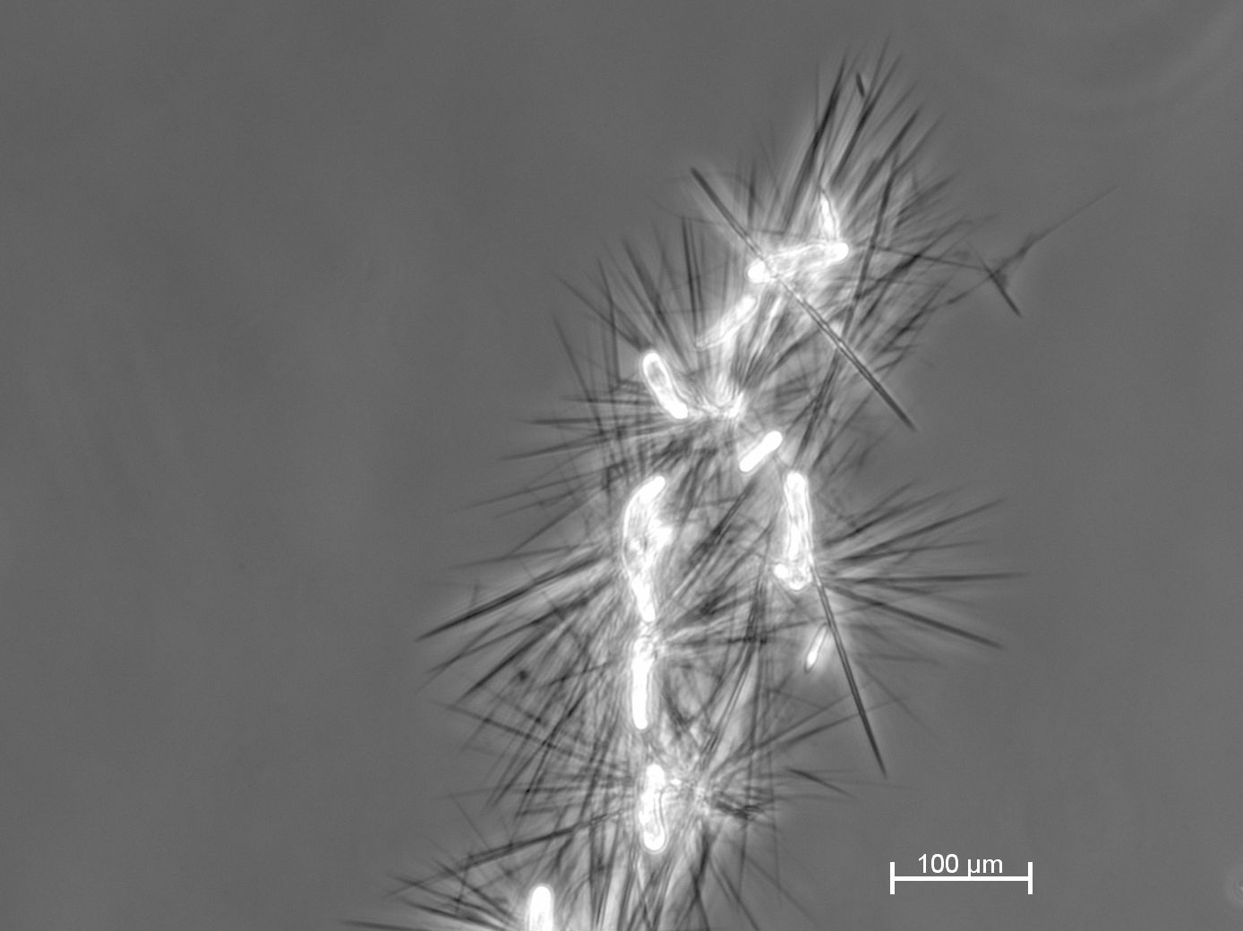 Cellobiose lipids (CL) are obtained as needle-shaped crystals from microbial fermentation.