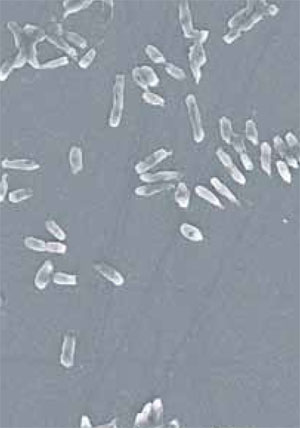 Structural changes of bacterial cells.