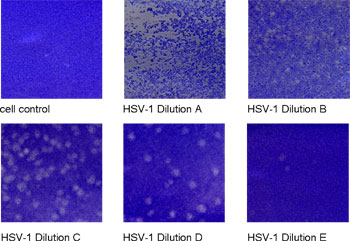 Plaque Assay von HSV-1 infizierten Vero B Zellen.