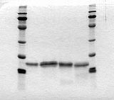 SDS-PAGE of interferon-gamma variants.