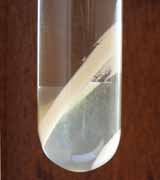 3 phases of a forced phase separation after centrifugation.