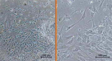 Human fibroblasts on multifunctional PEG hydrogels.