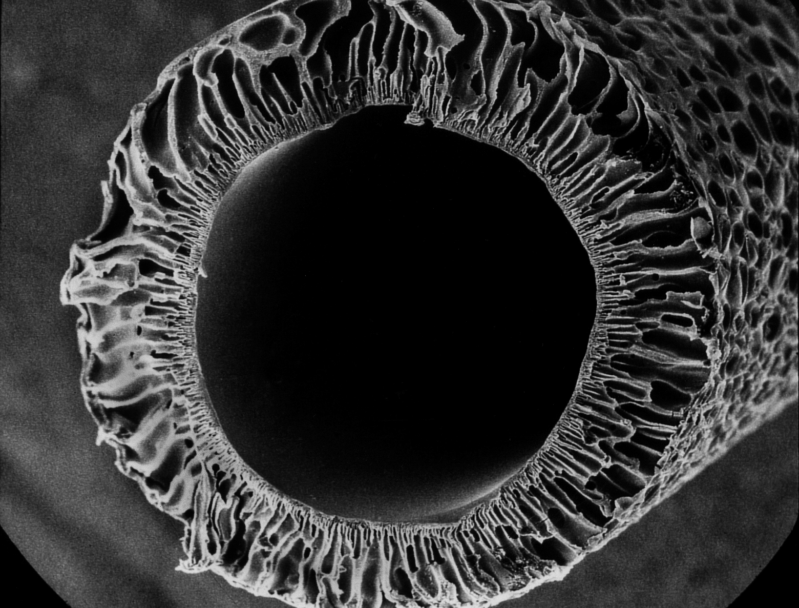 Fibre modification.