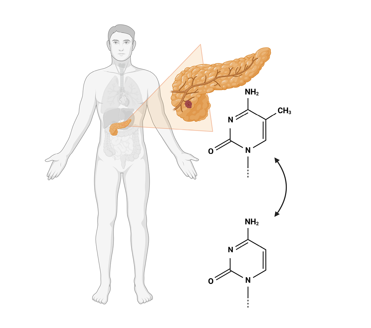 Diagnosis of pancreatic diseases using differential DNA methylation analysis (Created with Biorender.com)