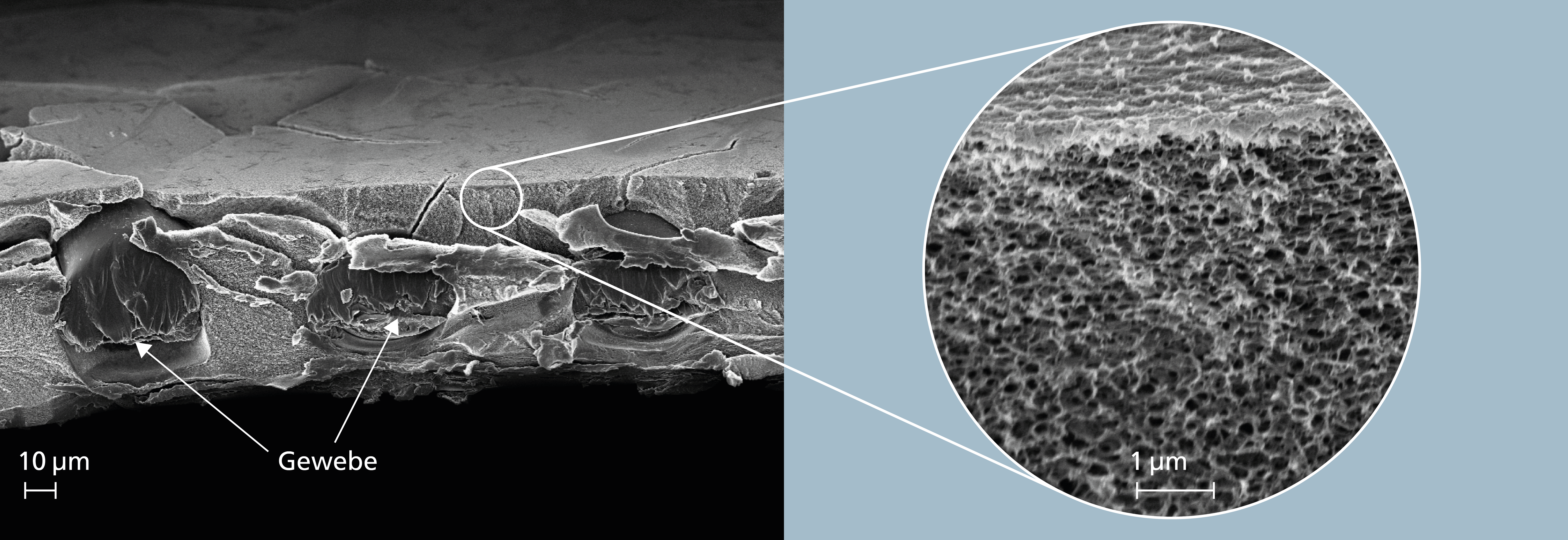 Cellulose acetate membrane under the electron microscope.