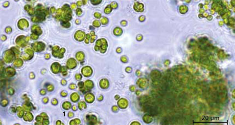 Microalgae Chlorella vulgaris, magnified 1000 times.