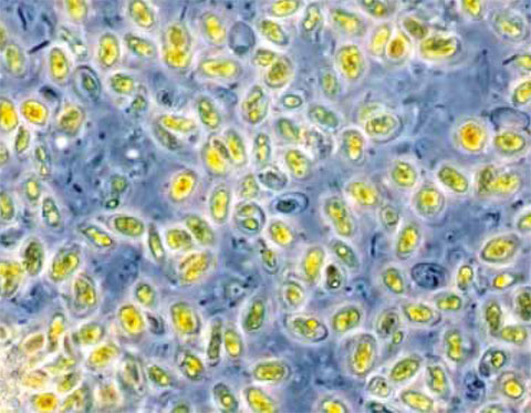 Microalgae Phaeodactylum tricornutum, magnified 1000 times.
