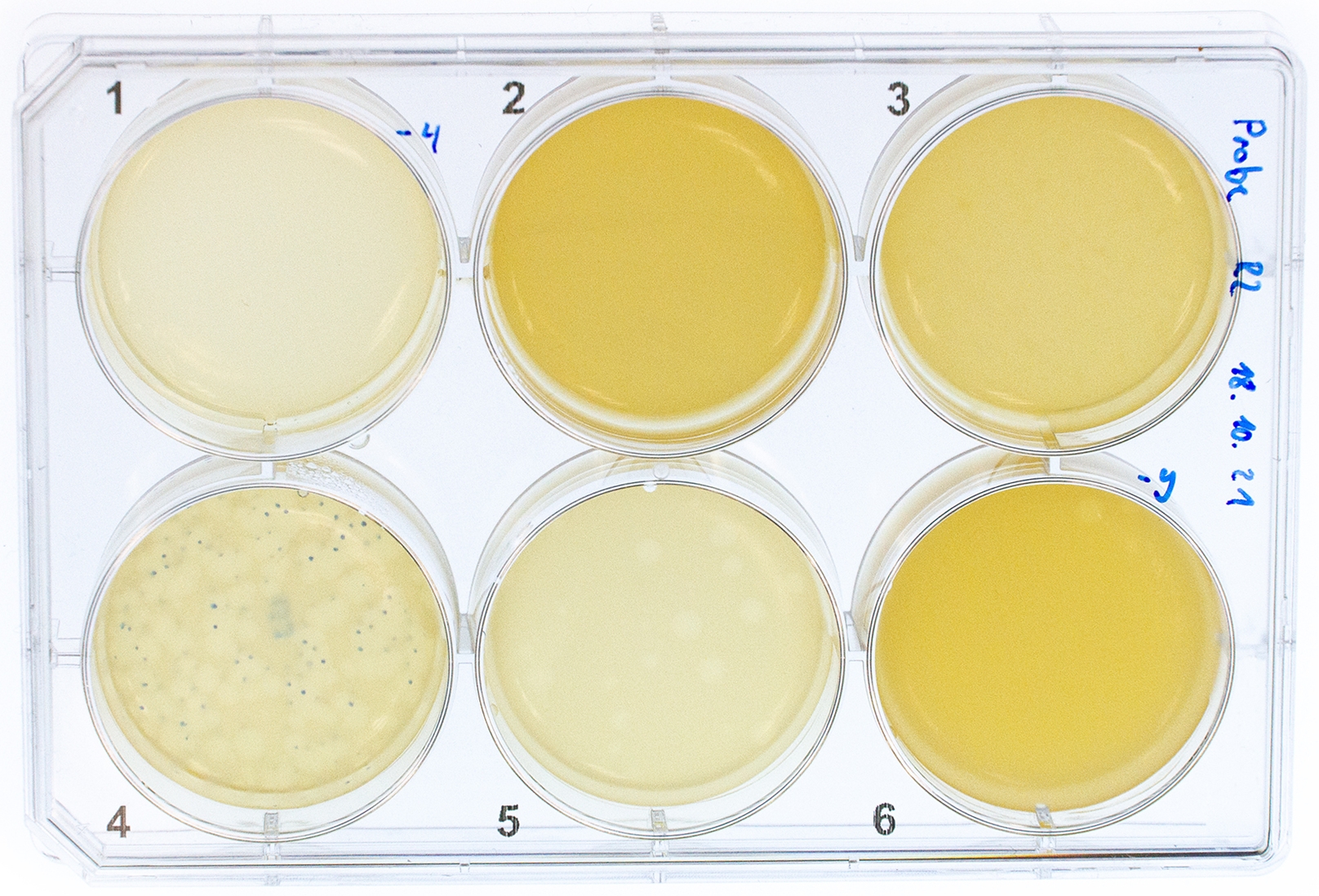 Bacteriophages on light table